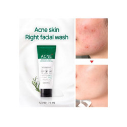 غسول الوجه من Acne 